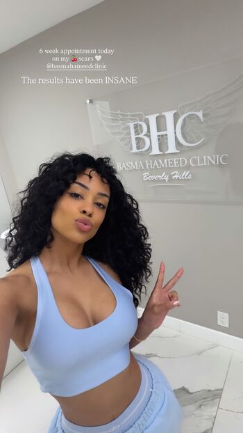 Full leaked Kristy sarah private onlyfans photo