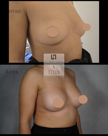 Full leaked Mia femtech private onlyfans photo