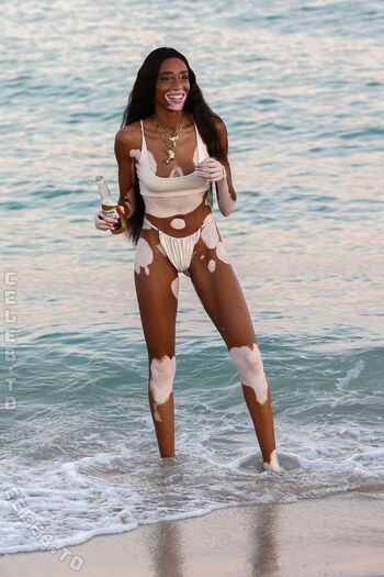 Full leaked Winnie harlow page private onlyfans photo
