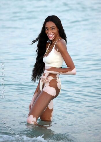 Winnie Harlow