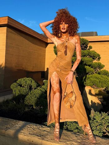 Full leaked Winnie harlow private onlyfans photo