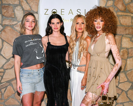 Full leaked Winnie harlow private onlyfans photo